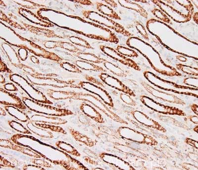 Anti-CPT1A antibody [8F6AE9](AB128568)