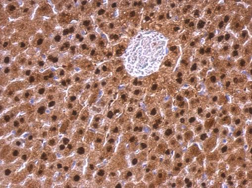 Anti-ADK antibody(AB227087)