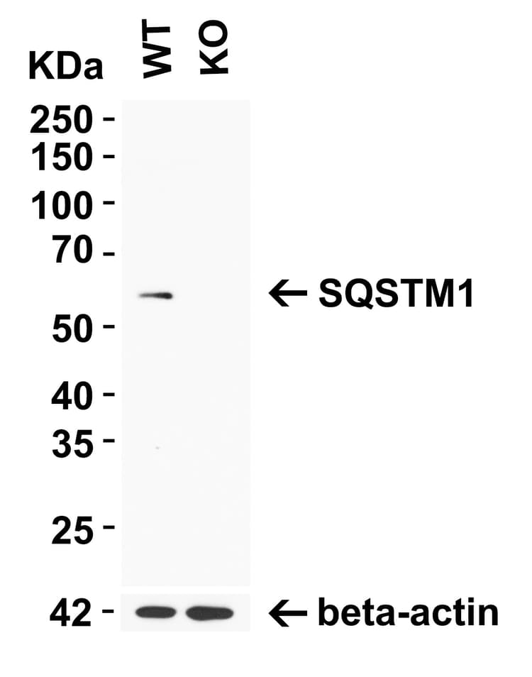 Anti-SQSTM1 / p62 antibody(AB91526)