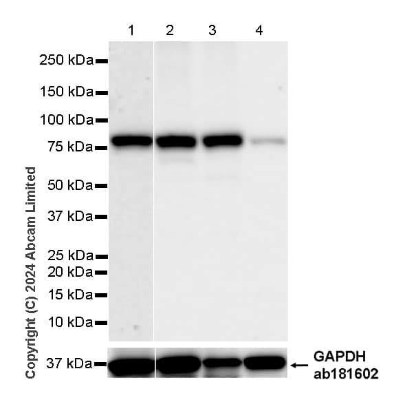 Anti-PADI2 / PAD2 antibody [EPR26940-85](ab322197)