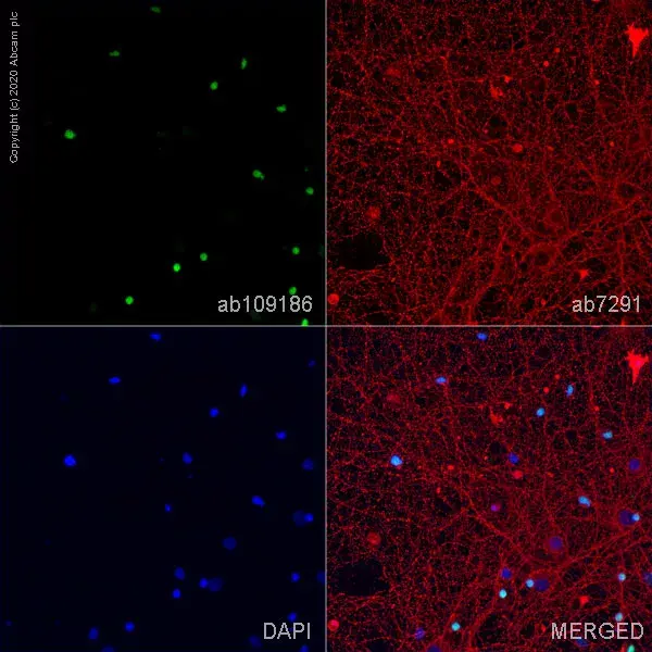 Anti-Olig2 antibody [EPR2673](AB109186)