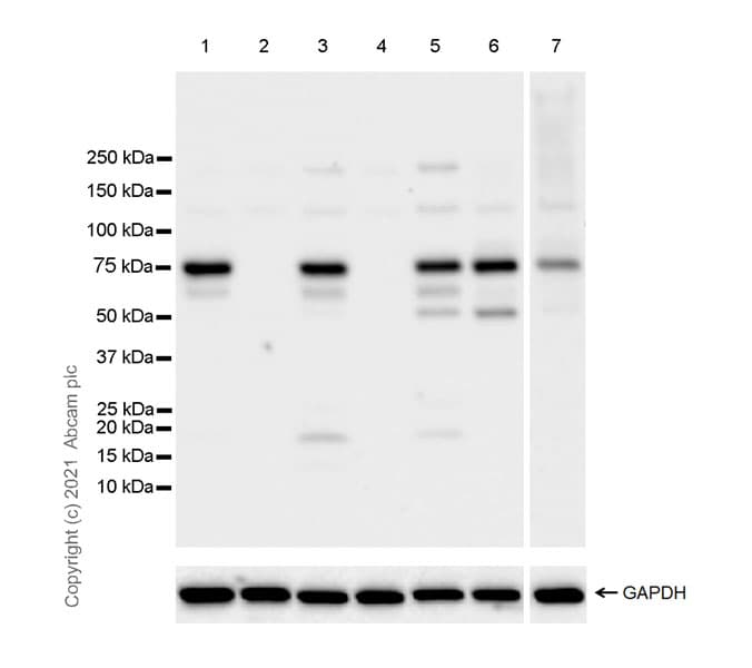Anti-GRHL2 antibody [EPR24386-76](AB271023)