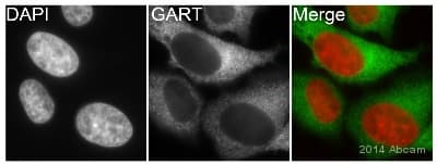 Anti-GART antibody [EPR11622](AB169550)