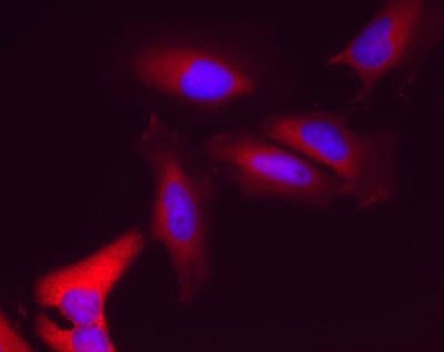Anti-Lactate Dehydrogenase LDHA + LDHB antibody [10E6AA9](AB112996)