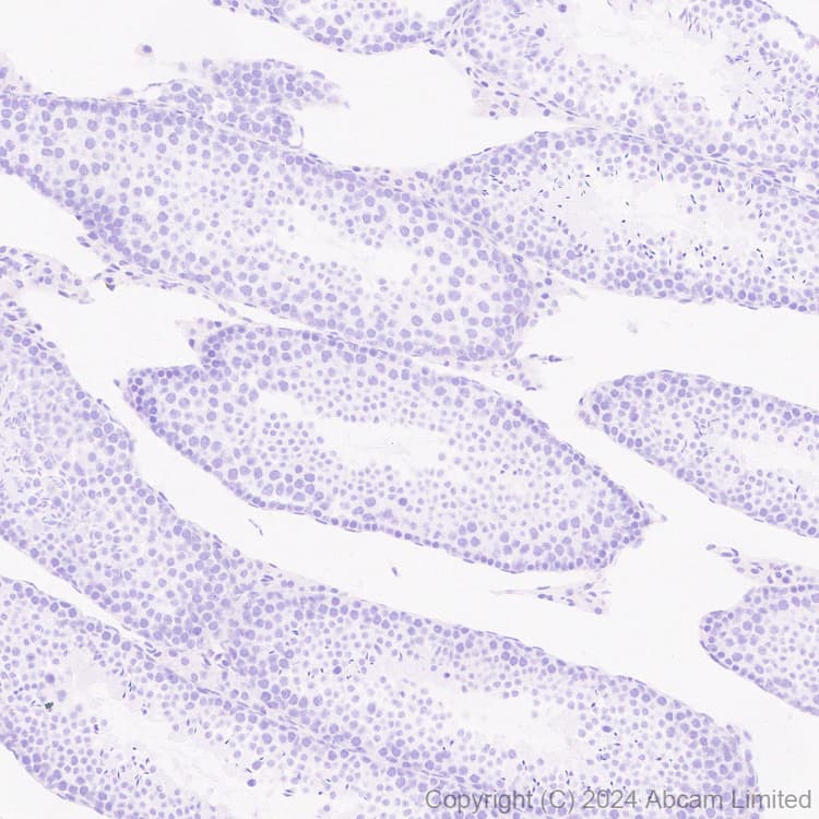 Anti-CXCL9 antibody [EPR28968-26](AB320827)