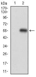 Anti Perilipin-2 antibody [2C5H8](AB181452)
