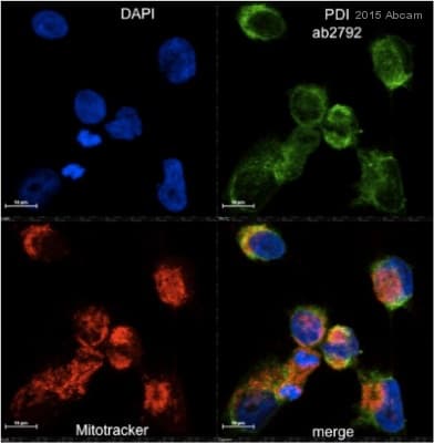 Anti-P4HB antibody [RL90](AB2792)