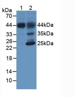 Hemojuvelin Antibody C6 Ab239495  Western Blot Img110257