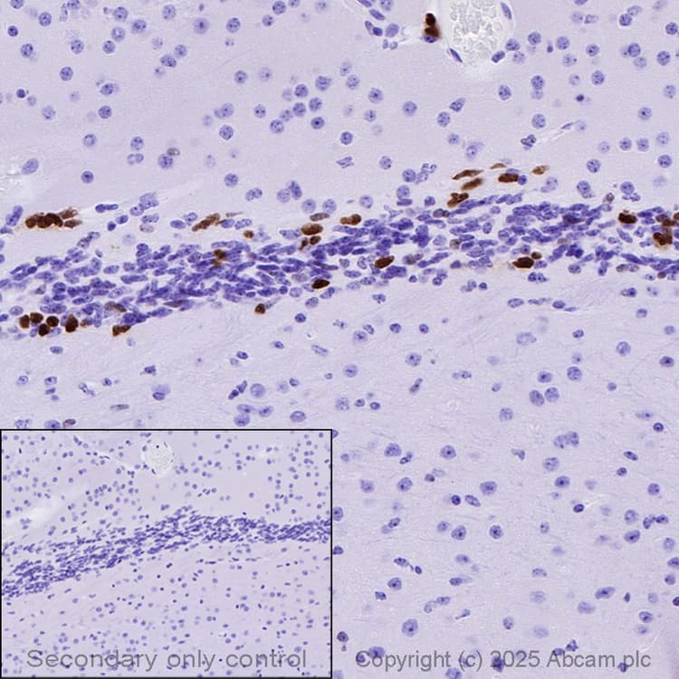 Anti-MASH1/Achaete-scute homolog 1 antibody [EPR19840](AB211327)
