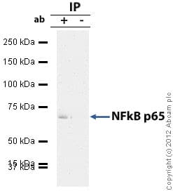 Anti-NF-kB p65 antibody(AB16502)