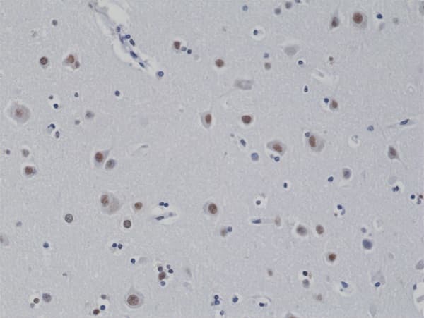Anti-5-methylcytosine (5-mC) antibody [RM231](AB214727)