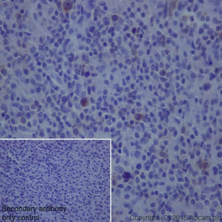 Il 2 Receptor Alpha Antibody Epr6452 Ab128955  Immunohistochemistry Formalin Pfa Fixed Paraffin Embedded Sections Img117830