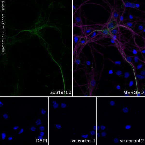 Pmca2 Antibody Epr28923 56 Bsa And Azide Free Ab319151  Immunocytochemistry Immunofluorescence Img435186
