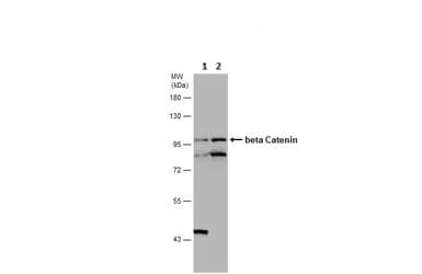 Anti-beta Catenin antibody - ChIP Grade(AB227499)
