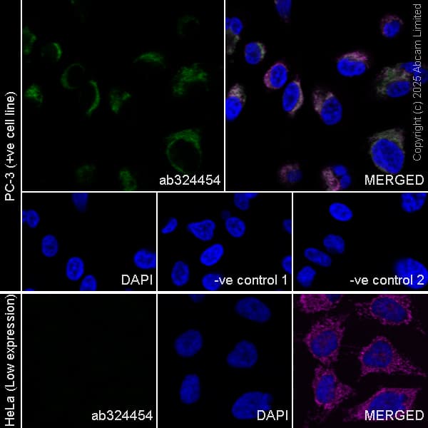 Cox Iv Antibody Mabcam33985 Mitochondrial Marker Ab33985  Immunocytochemistry Immunofluorescence Img447546