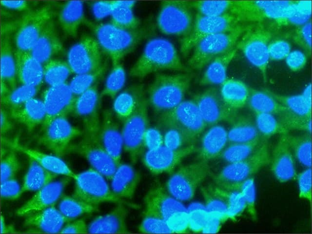 Caspase 3 Antibody Ab49822  Immunocytochemistry Immunofluorescence Img33928