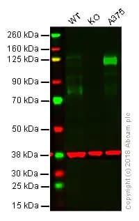 Anti-CD146 antibody [EPR3208](ab75769)