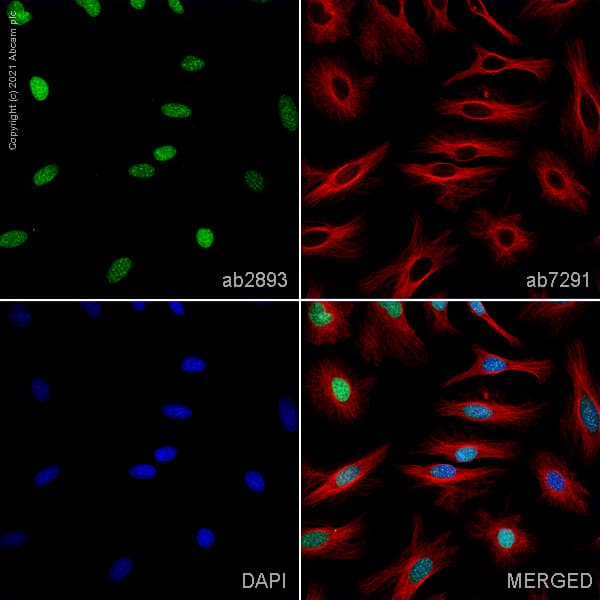 Anti-gamma H2A.X (phospho S139) antibody(AB2893)