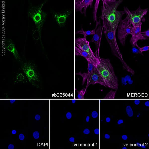 Anti-Sarcomeric Alpha Actinin antibody [EA-53](AB9465)