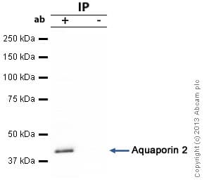 Acaa1 Beta Ketothiolase Antibody 2h6be7 Ab110289  Immunoprecipitation Img20585