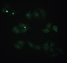 Anti-beta 2 Microglobulin antibody [D2E9](AB198486)