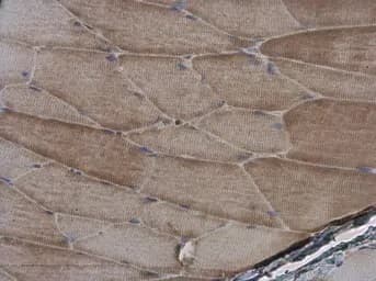 Anti-Sarcomeric Alpha Actinin antibody(AB137346)