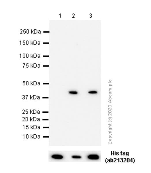 Anti-Aldolase B + Aldolase C antibody [EPR3138Y](ab75751)