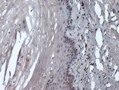 Anti-Rad51 antibody [14B4](AB213)