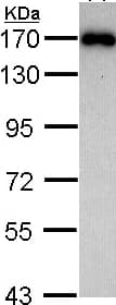 Aip1 Antibody Ab97343  Western Blot Img152566