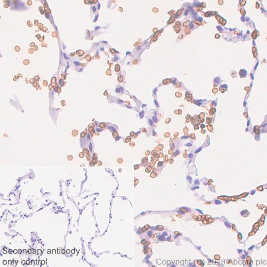 Anti-Glucose Transporter GLUT1 antibody [SP168](AB150299)