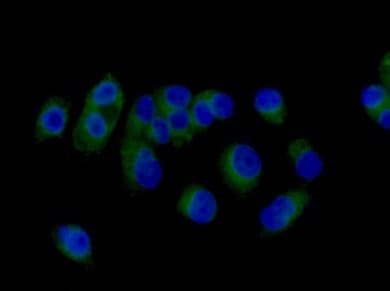 Anti-RAB8A antibody [EPR14873] - BSA and Azide free(AB271954)