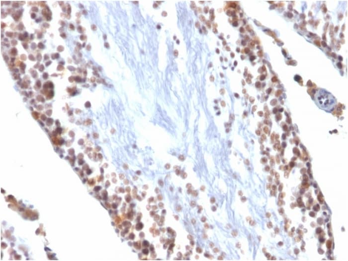 Anti-Wilms Tumor Protein antibody [WT1/857](AB220212)
