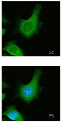 Casr Antibody Ab137408  Immunocytochemistry Immunofluorescence Img72656