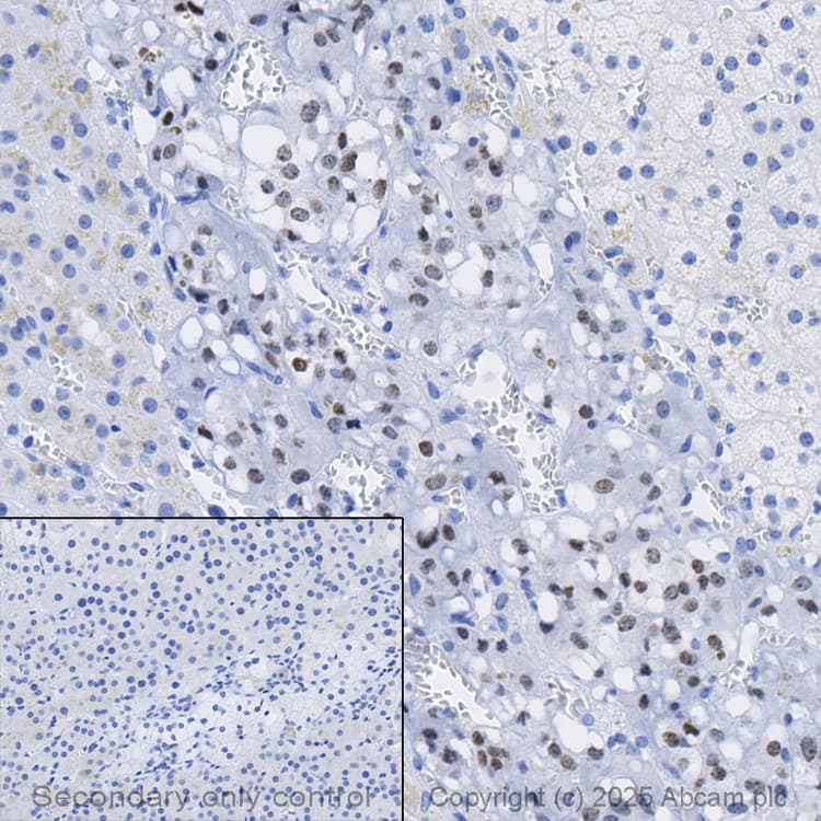 Anti-PHOX2B antibody [EPR14423] - C-terminal(AB183741)