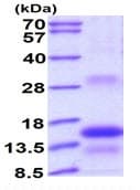 Recombinant Human TSH beta protein (denatured)(AB176027)