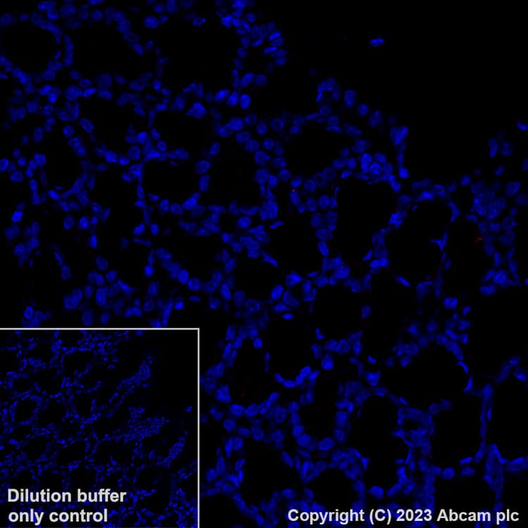 Alexa Fluor® 647 Anti-LAMA1 antibody [EPR27258-37](ab315852)