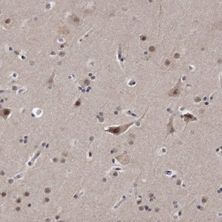 Klhdc3 Antibody Ab272605  Immunohistochemistry Formalin Pfa Fixed Paraffin Embedded Sections Img106929
