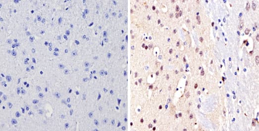 Anti-NCOR2/SMRT antibody(ab5802)