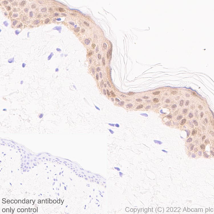 Anti-IL-1RA antibody [EPR26853-58](AB303490)