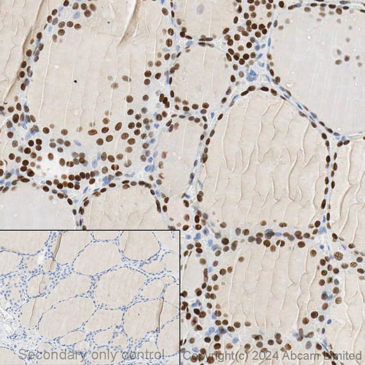 Anti-TTF1/Nkx2-1 antibody [EP1584Y](AB76013)