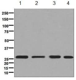 Rpl13 Antibody Epr8828 Bsa And Azide Free Ab248754  Western Blot Img32731
