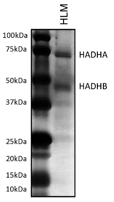 Anti-HADHB antibody [5C3AB7](AB110301)