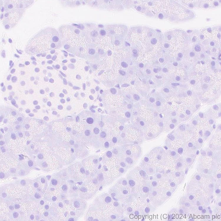 Anti-Adenovirus Type 5 Hexon antibody [EPR28237-57](AB316852)