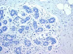 Anti-Myosin light chain 3 antibody [EPR4160] - BSA and Azide free(AB247710)