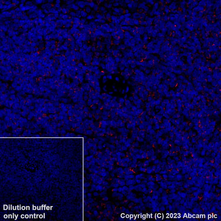 Alexa Fluor 647 Mthfd2 Antibody Epr26938 20 Ab314930  Immunohistochemistry Formalin Pfa Fixed Paraffin Embedded Sections Img422269