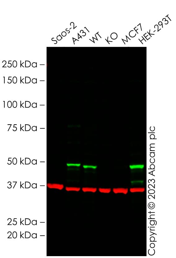 Anti-p53 antibody [DO-1] - ChIP Grade(AB1101)