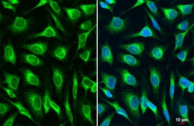 Lass2 Antibody Hl1717 Ab308189  Immunocytochemistry Immunofluorescence Img407275