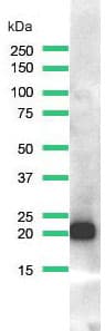 Anti-Ras (mutated Q61R) antibody [SP174](AB227658)