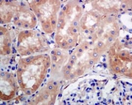 Anti-RAB7 antibody [EPR7589](AB137029)