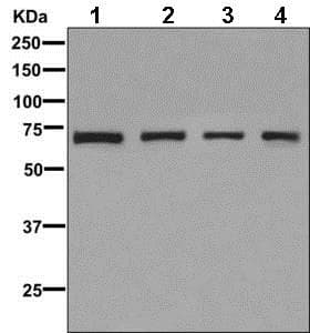 Cr1l Antibody Epr9604b Bsa And Azide Free Ab249495  Western Blot Img116333
